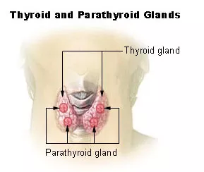 Primary Hyperparathyroidism